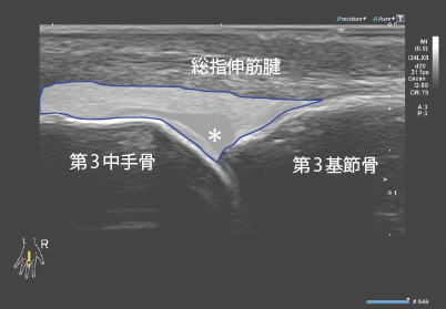 Point-of-Care超音波 POCUS 原書第2版 Point-of-Care超音波 原書第2版 ―電子書籍(日本語・英語版)付